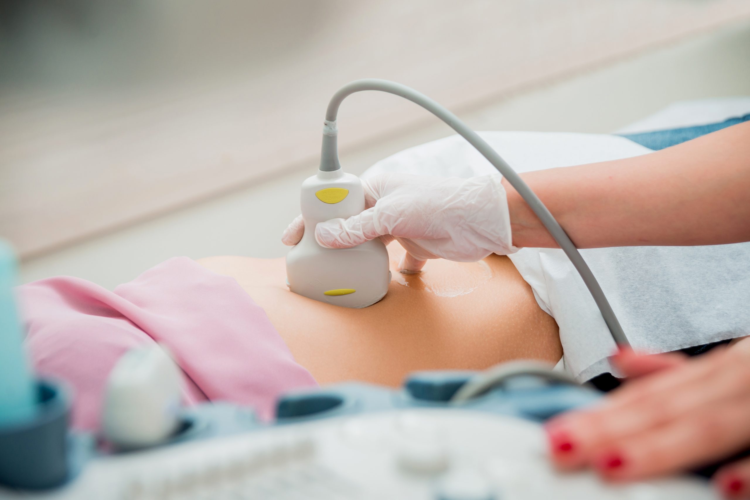 Ultrasound scanner in the hands of a doctor. Diagnostics. Sonography